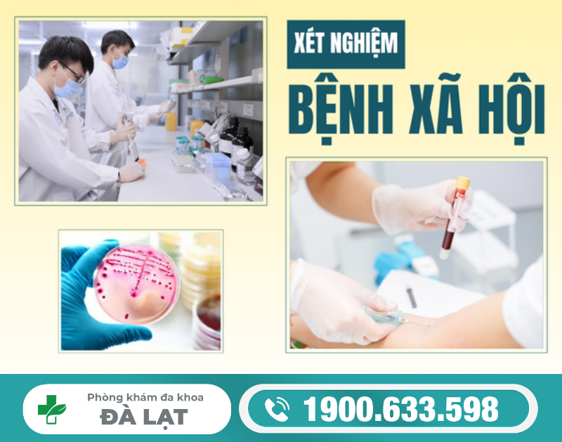 Hình ảnh minh họa